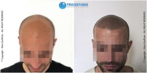 effetto rasato