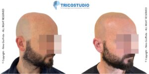 effetto rasato