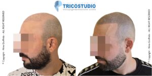 effetto rasato