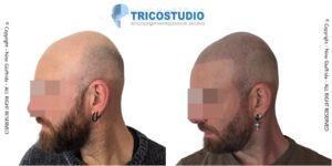 effetto rasato