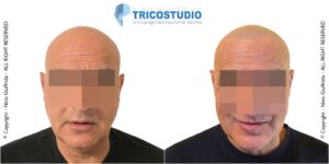 effetto rasato