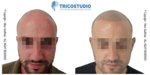 effetto rasato