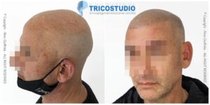 effetto rasato