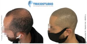 effetto rasato