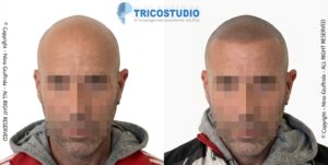 effetto rasato
