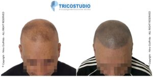 effetto rasato