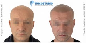 effetto rasato