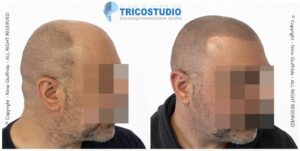 effetto rasato