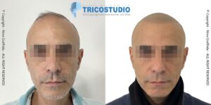 effetto rasato