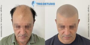 effetto rasato