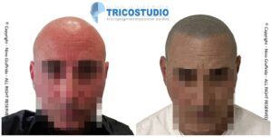 effetto rasato