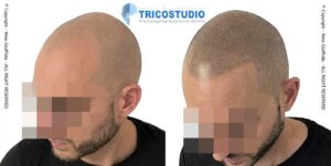 effetto rasato