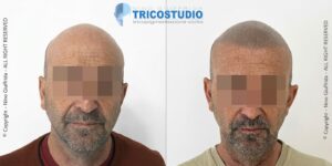 effetto rasato