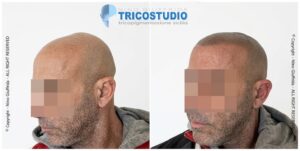 effetto rasato