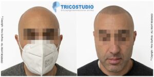 effetto rasato