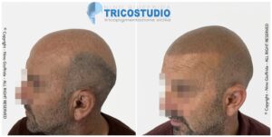 effetto rasato