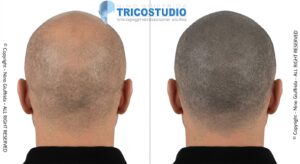 effetto rasato