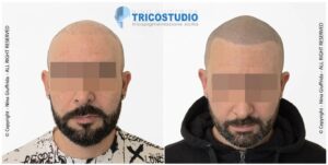 effetto rasato