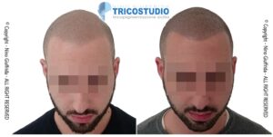 effetto rasato